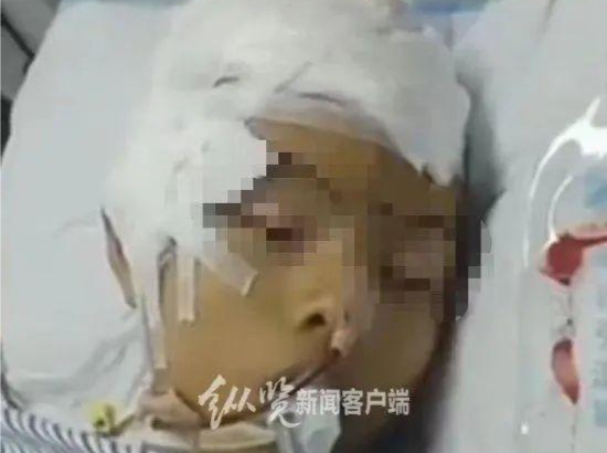 中学生被打成植物人？广东阳春教育局：因双方口角 伤者被两名同学打伤