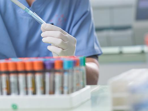 日本研究揭示中年代谢能力下降的分子机制