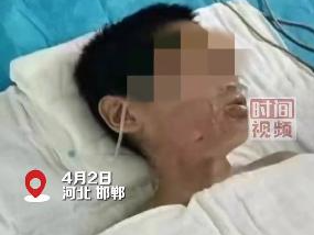 河北邯郸通报“一男生被同学灌开水烫伤”：已对相关学生进行处理