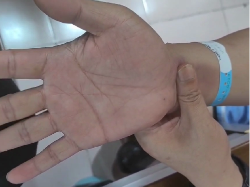 男子颈椎间盘突出+腕管综合征，南城医院康复科给这样治疗了