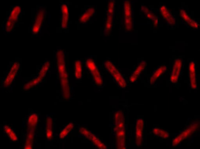 精准诊断疑难结核病，卢洪洲教授团队研发出新型活菌代谢标记技术