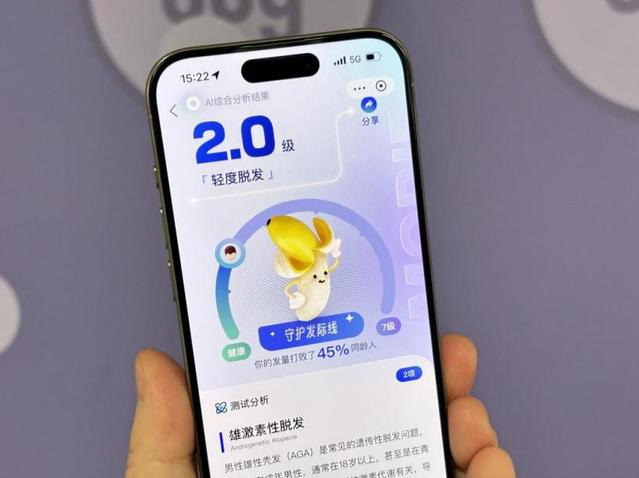 你是“发量富人”还是“葱明不绝顶”？支付宝推AI“神器”，拍照自测脱发程度