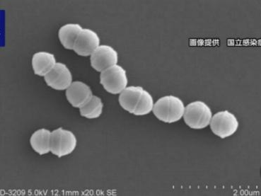 正快速蔓延！致死率高达30%，日本已上千人感染“食人菌”