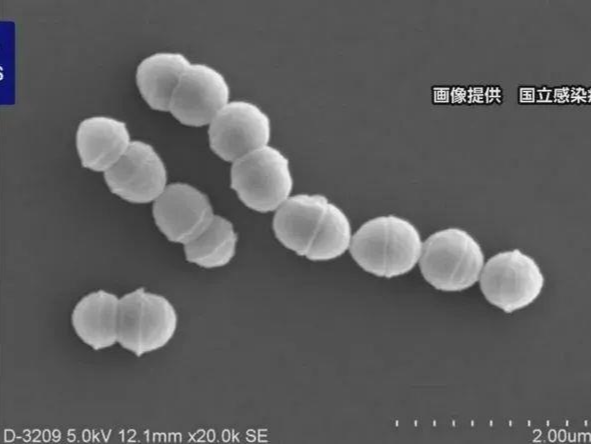 日本“食人菌”感染病例超1100例
