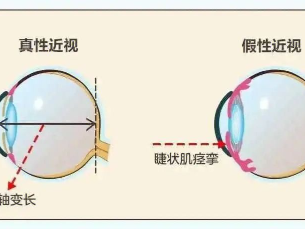 官方辟谣｜吃胡萝卜真能预防近视眼吗？