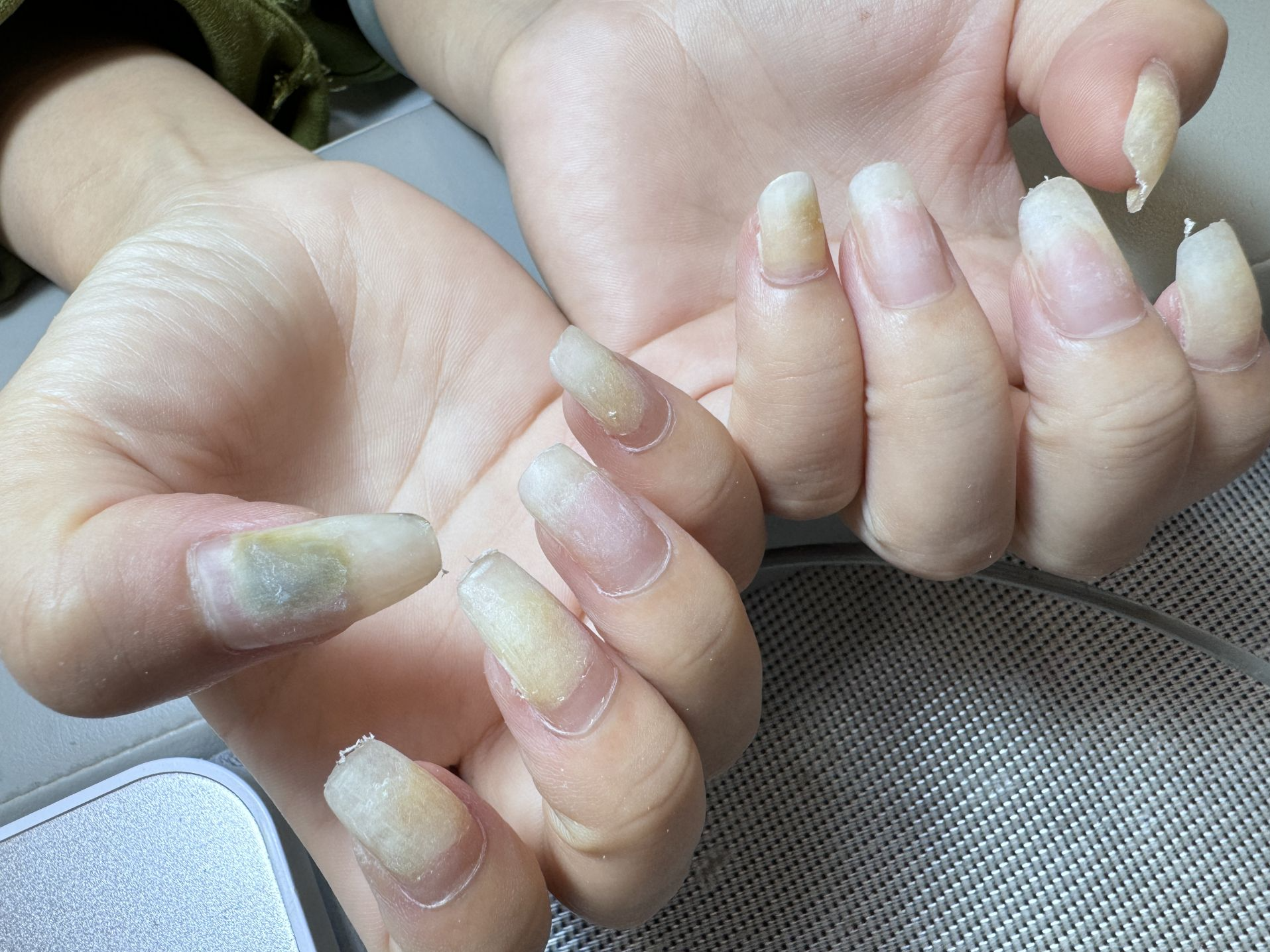 指甲“发霉”了?云南女子做美甲感染绿脓杆菌,专家建议→