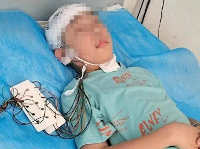 男孩被同学打成重伤，智力倒退成幼儿！打人者因未满14岁未受行政、刑事处罚