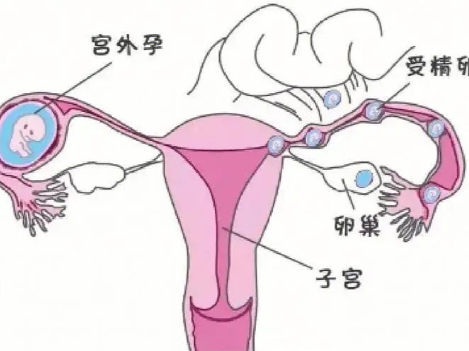 专家科普｜孩子长在这个位置真“要命”，警惕二胎三胎的“绊脚石”