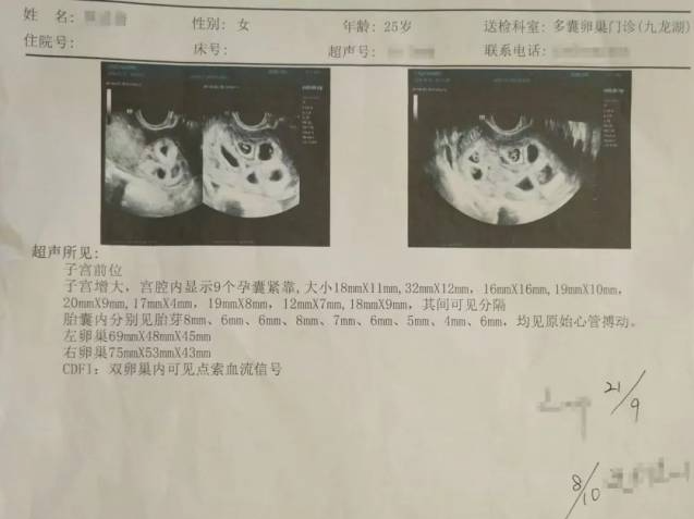 罕见！南昌一女子怀上九胞胎 