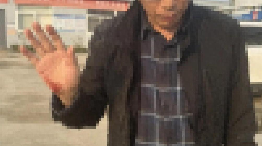 两名新华社记者在安徽采访遭殴打
当地警方回应