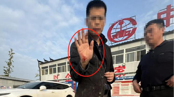 中国记协：2名遇袭记者人身安全 手机已退回 将维护记者正当采访合法权益