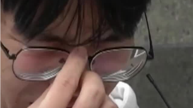 厨房爆炸救妻丈夫已不幸去世