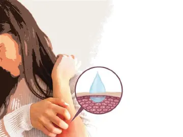 晶报特别报道 | 冬天皮肤痒？医生：洗澡莫洗“伤”，多用保湿霜，食补要跟上