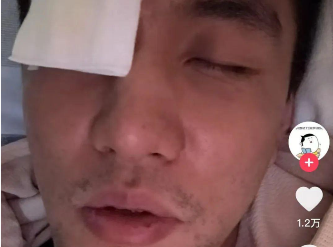 郭艾伦眼睛流血缝40多针，本人发声：以后可能打不了篮球了