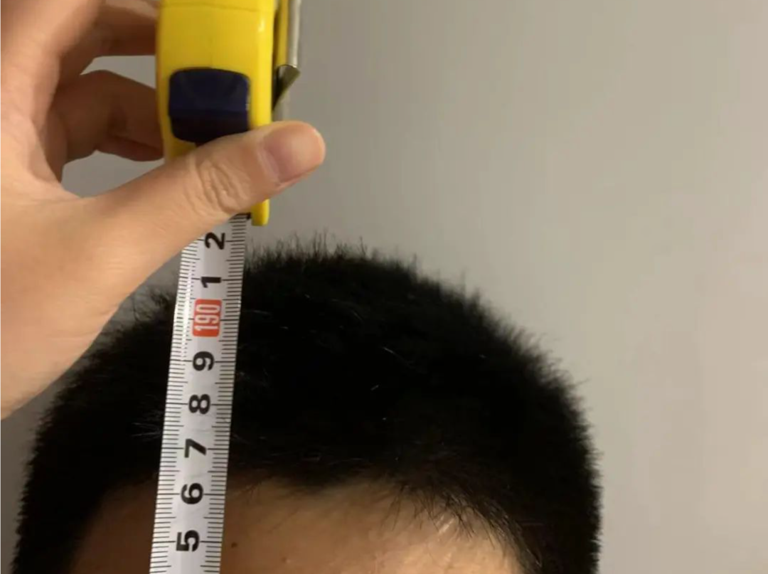 专家科普｜矮小、早熟、肥胖……孩子生长发育异常？家长看看这个 