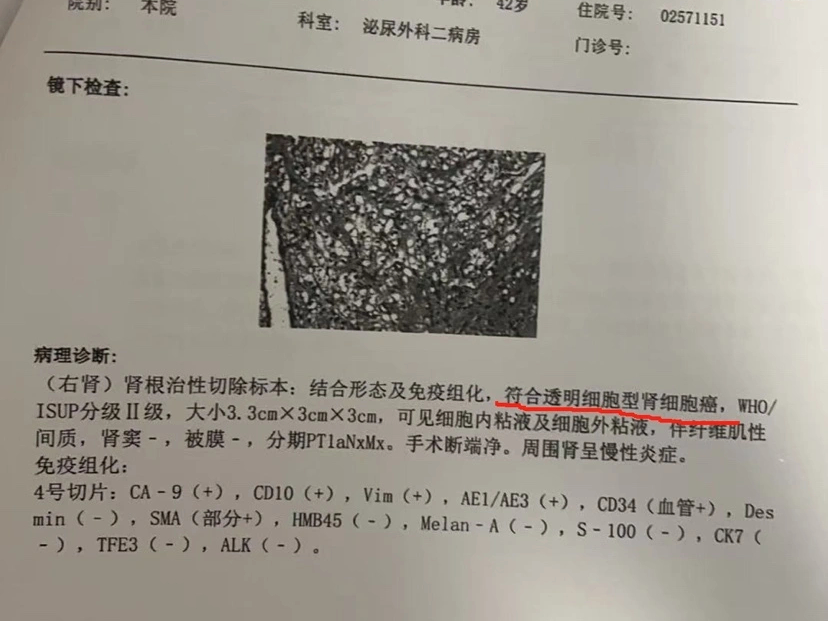 体检10年未做出癌症预警，患癌女律师质疑爱康国宾“误检、漏检”