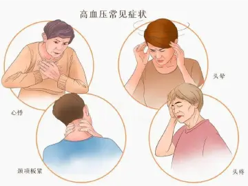 专家科普｜血压突然飙升别傻等120！先做这1步，缓解症状争生机
