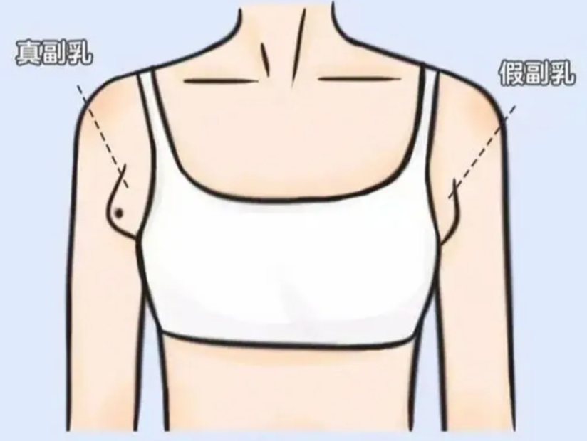 专家科普｜人类本该有6-8对乳房？