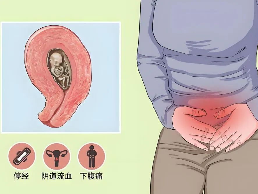 专家科普｜胚胎停育很痛心，减少创伤从头再来 