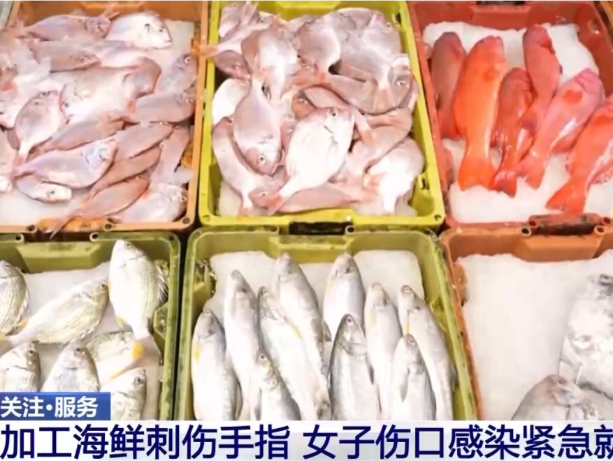 当心“海洋刺客”！男童沙滩踩到死鱼感染这种病菌，险些截肢