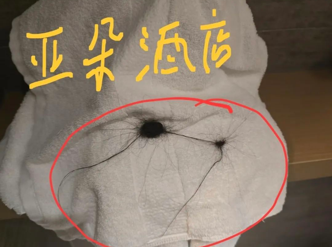 深圳一亚朵酒店被曝卫生问题！“毛巾缠两团头发”……网友：很膈应