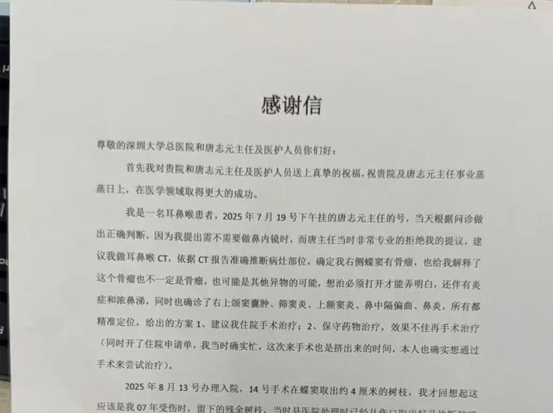 反复鼻塞、流涕，元凶竟是在鼻子里“藏”了18年的树枝