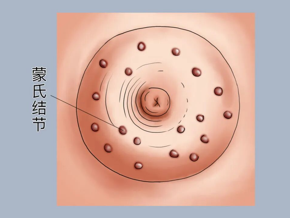 专家科普|胸部的这些小结节,作用竟然这么大(不论男女)