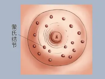 专家科普|胸部的这些小结节,作用竟然这么大(不论男女)