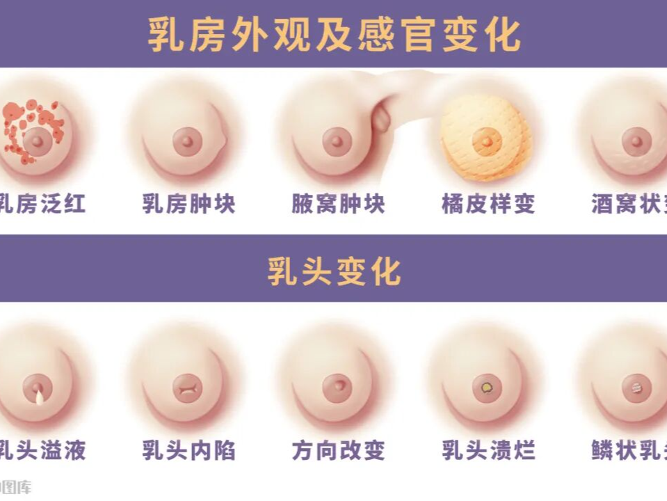 专家科普｜乳头痒痒的，怎么办？ 