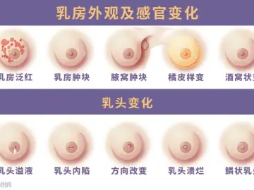 专家科普|乳头痒痒的,怎么办?