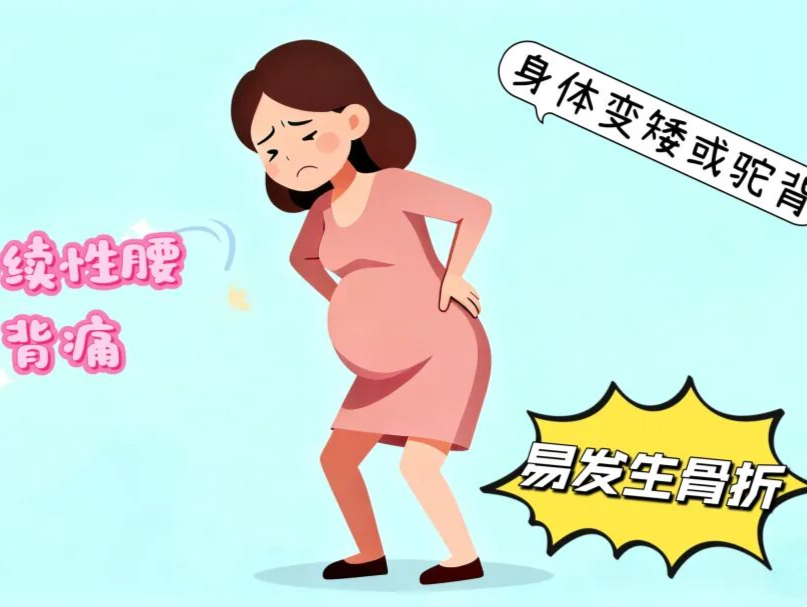 孕妇学校 | 孕期骨质疏松：甜蜜负担下的“骨量小偷” 