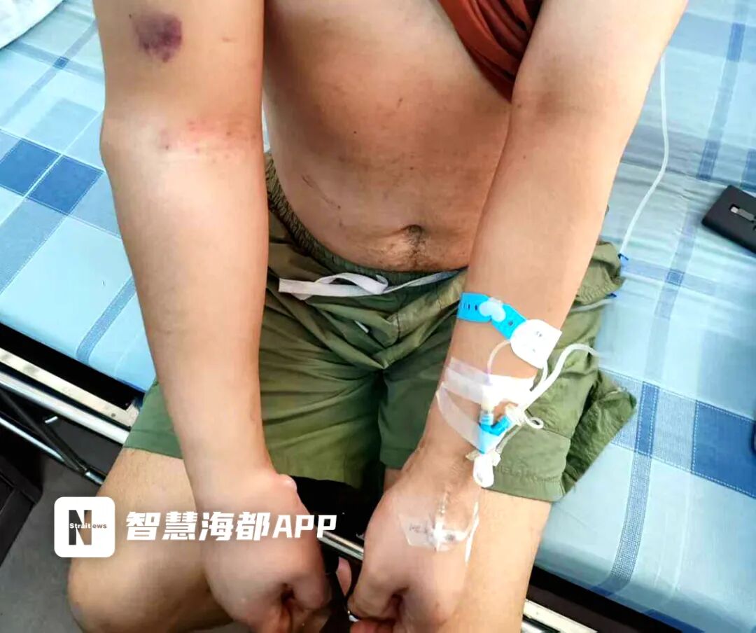 泉州28岁小伙醉酒后熟睡，差点废掉一条胳膊！警惕这5个危险信号！