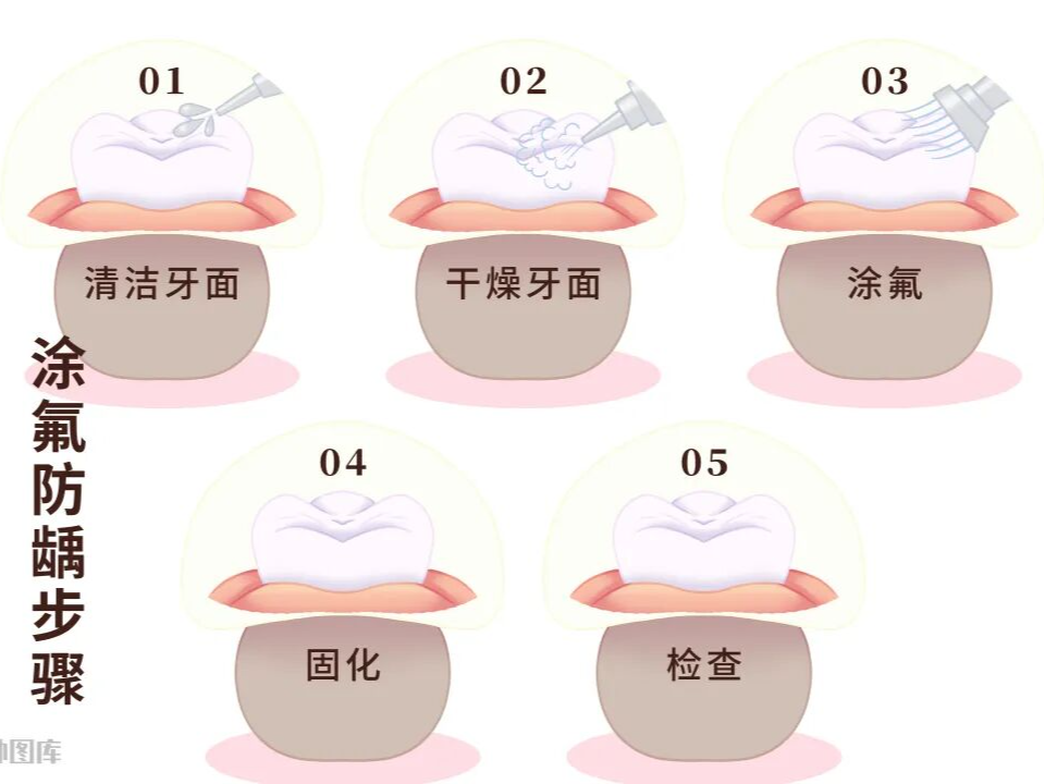 品质服务|爸妈也需要涂氟吗?