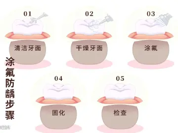 品质服务|爸妈也需要涂氟吗?