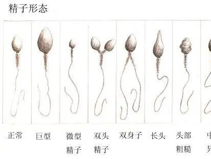 专家科普|无精、弱精、精子畸形……还能生吗?