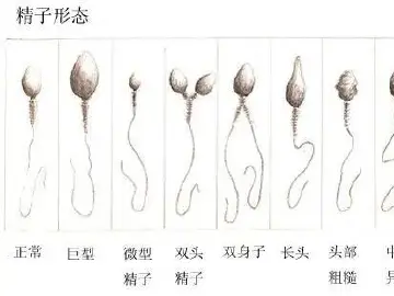 专家科普|无精、弱精、精子畸形……还能生吗?
