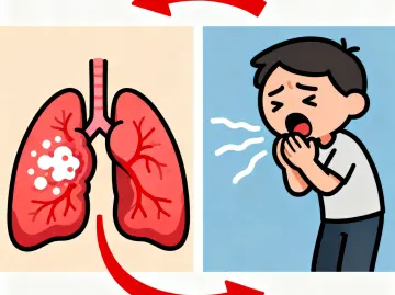 专家科普|到底是先有“咳嗽”,还是先有“肺炎”?