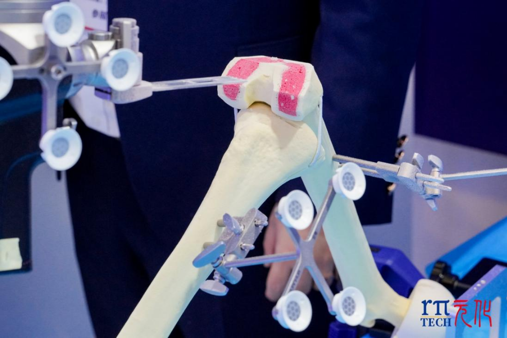 攻克专用机械臂核心技术！深圳企业携自研骨科手术机械臂亮相天津