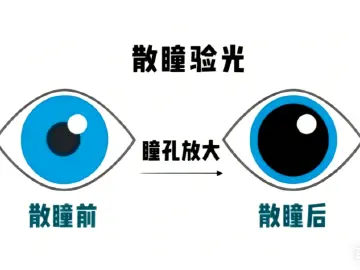 专家科普|一个假期娃视力从1.0降到0.5,可能吗?