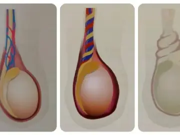 专家科普|男孩总喊“蛋疼”,千万别不当回事