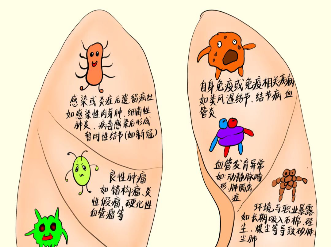 有医说医｜胸外科医生怒拆3个谣言，90%的人都慌错了！