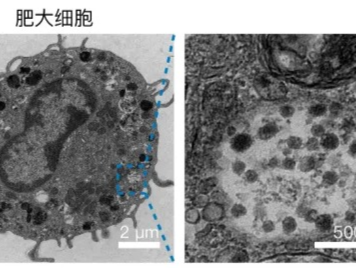中国科学家，发现抗癌“新利器”！