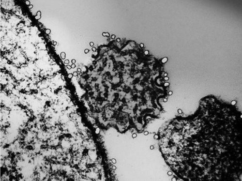 印度政府：目前仅确诊两例尼帕病毒病病例
