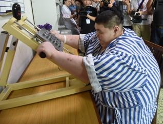 全国首胖手术减重切8成胃 预计1年半降至200斤 
