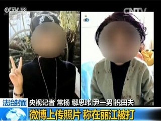 女子丽江被打毁容”案或于本月内开庭 被告人表达歉意
