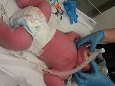 破纪录！新西兰一产妇生下15斤巨婴 身长57厘米