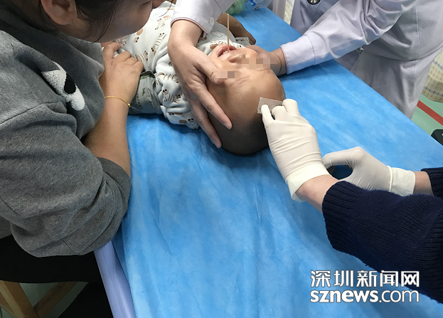  家长别再马大哈！一岁孩子吃热狗致竹签插喉险酿恶果