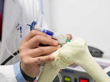 3D打印含镁骨修复材料：为缺损骨骼“牵线搭桥”