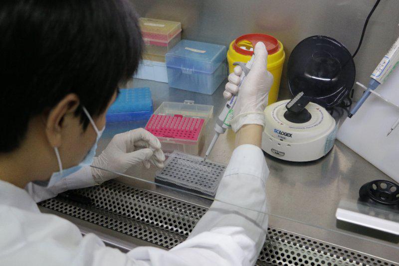 查肠癌有了新方法 取排泄物就可快筛