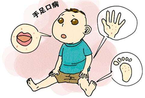 手足口病来势汹汹！别忘打疫苗预防 
